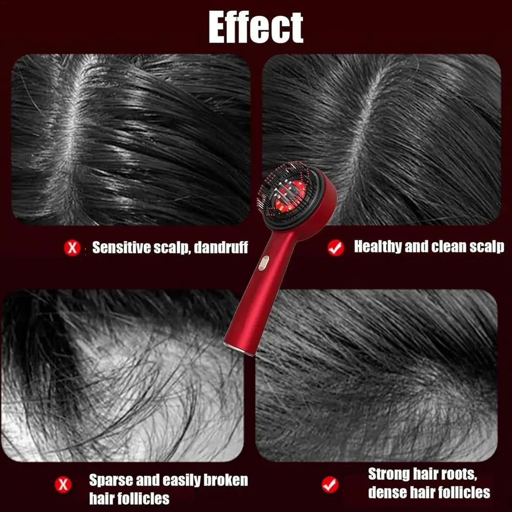 Scalp Massage Comb 2 in 1 Hair Oil Applicator Hair Massager Electric Scalp Massager Scalp Massaging Brush for Stimulates Hair - Image 15
